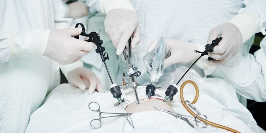 Laparoscopic Cancer Surgery in Bangalore | Minimally Invasive Cancer Care