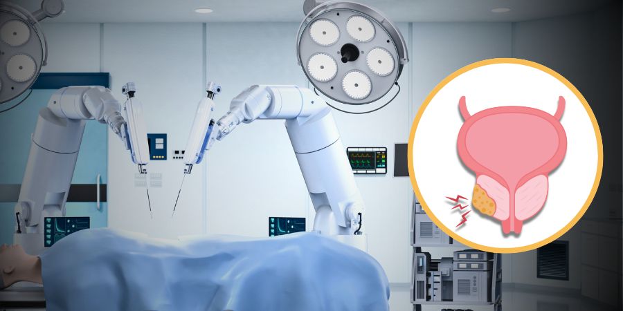 Robotic Surgery For Prostate Cancer In Bangalore,  