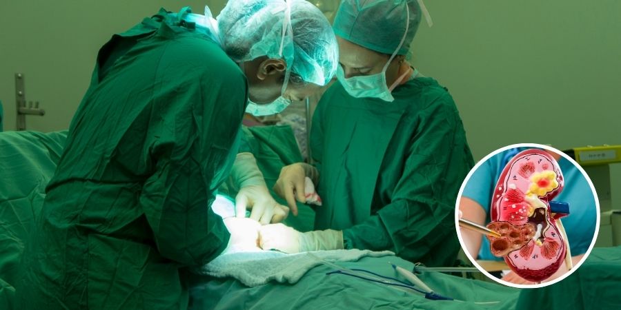 Penile Cancer