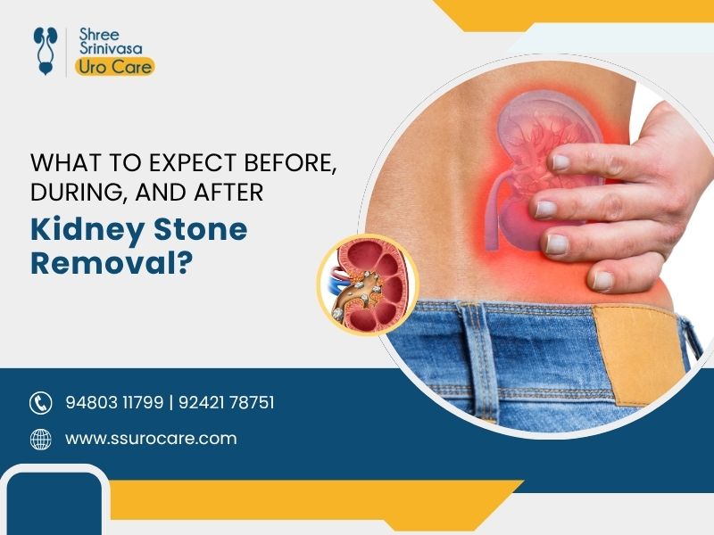 Kidney Stone removal in Bangalore